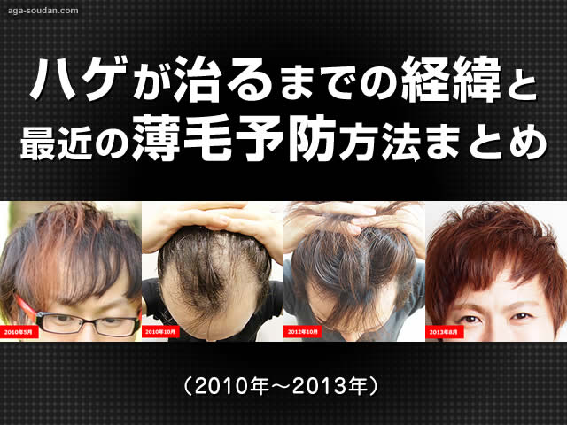 【AGA薄毛治療】ハゲが治るまでの経緯と現在の薄毛予防方法まとめ-00