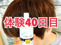 【体験40日目】ミノキシジル世界最高濃度[フォリックスFR16]育毛効果