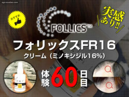 【体験60日目】ミノキシジル16％[フォリックス]育毛効果【写真あり】