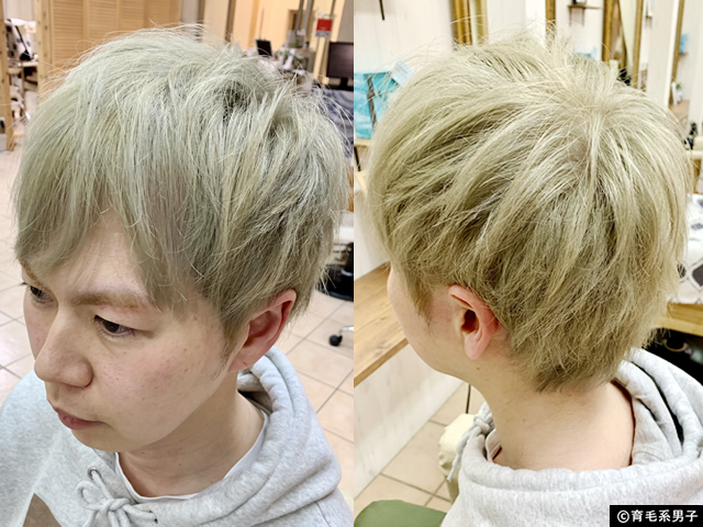 【M字はげ】薄毛と白髪が目立たないヘアスタイル(AGA治療中/40代)-01