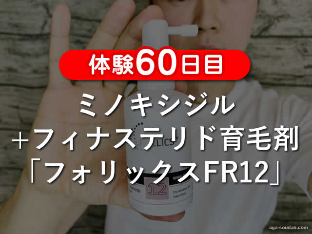 【体験60日目】ミノキシジル+フィナステリド育毛剤フォリックスFR12-00
