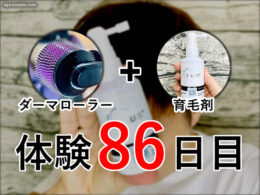 【体験86日目】ダーマローラー+育毛剤(ミノキシジル15％)経過報告