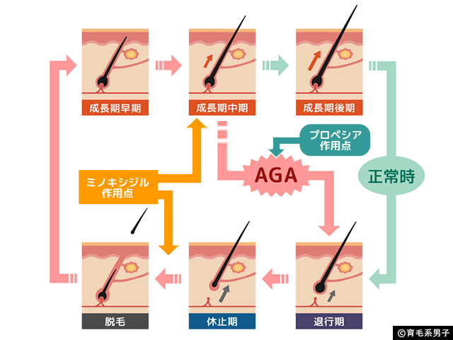 【AGA治療】ミノキシジル内服と外用は別物と考える(効果と副作用)-01
