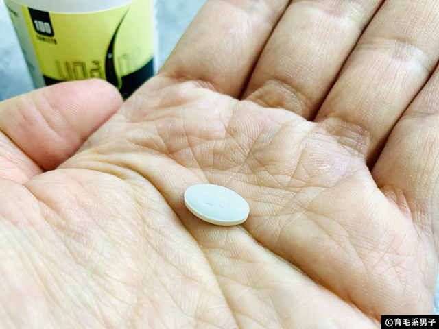 【AGA治療】SAVAミノキシジルタブレット(内服薬)効果と副作用-03