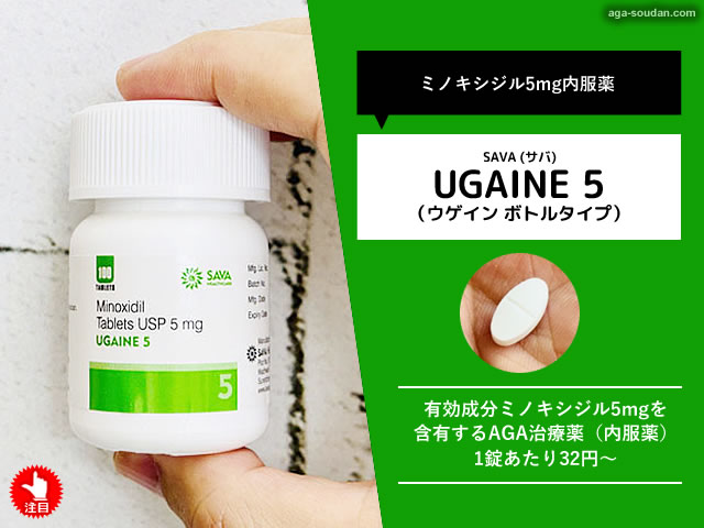 【AGA治療薬】ミノキシジル5mg内服薬「ウゲイン5」値段と効果-00