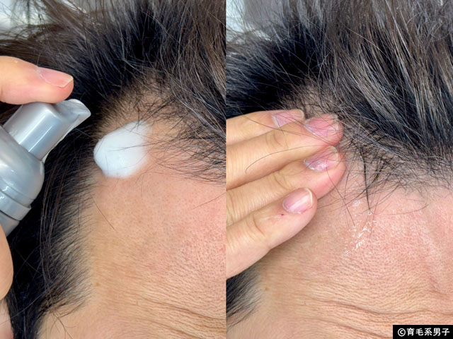 髪の未来を変える！RapidHair®（ラピッドヘア）で始める本気のスカルプケア｜育毛・発毛の違いも徹底解説-04