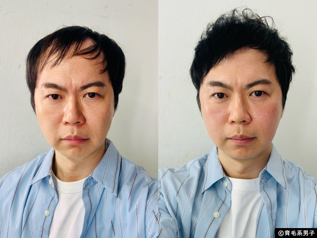 【薄毛隠しスプレー】CAX（カックス）て本当にバレない？実際に使ってみたリアルな感想と正しい使い方-09