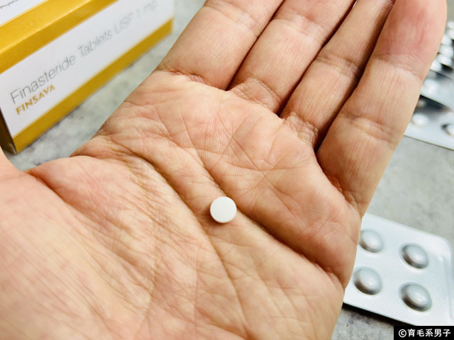 【プロペシアの真実】フィナステリドは本当に必要？9年間飲み続けて見えた“AGA治療の限界”-02