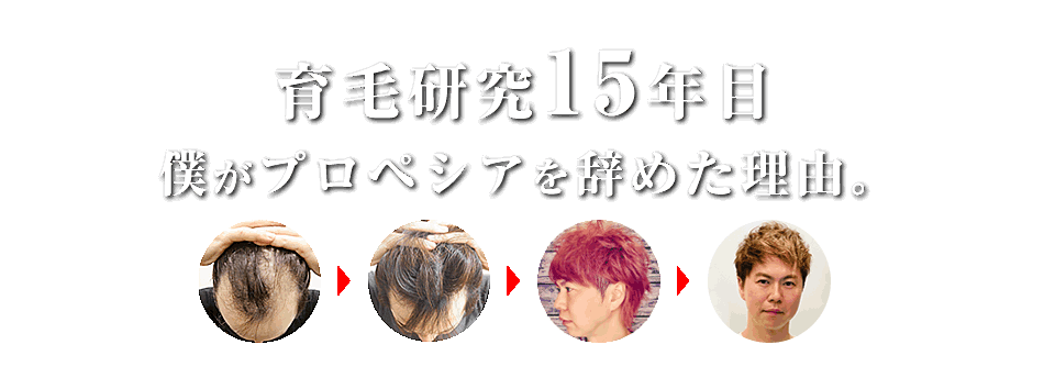 僕がプロペシアを辞めた理由 Byさちお（旧：育毛系男子）