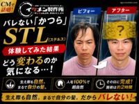 【CMで話題】イケメン製作所の”バレない”かつら「STL（ステルス）」を体験してみた結果-00