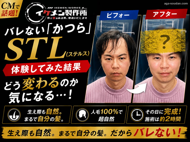 【CMで話題】イケメン製作所の”バレない”かつら「STL(ステルス)」を体験してみた結果-00