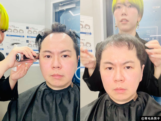 【CMで話題】イケメン製作所の”バレない”かつら「STL(ステルス)」を体験してみた結果-05