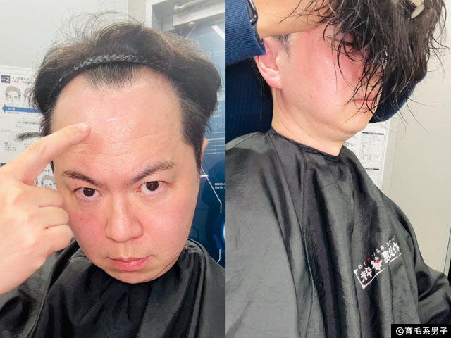 【CMで話題】イケメン製作所の”バレない”かつら「STL(ステルス)」を体験してみた結果-07