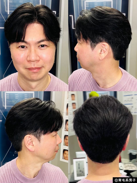 【CMで話題】イケメン製作所の”バレない”かつら「STL(ステルス)」を体験してみた結果-12